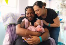 Conjoined Twin Sisters Undergo Successful Surgical treatment to Separate at 4 Months Old-fashioned