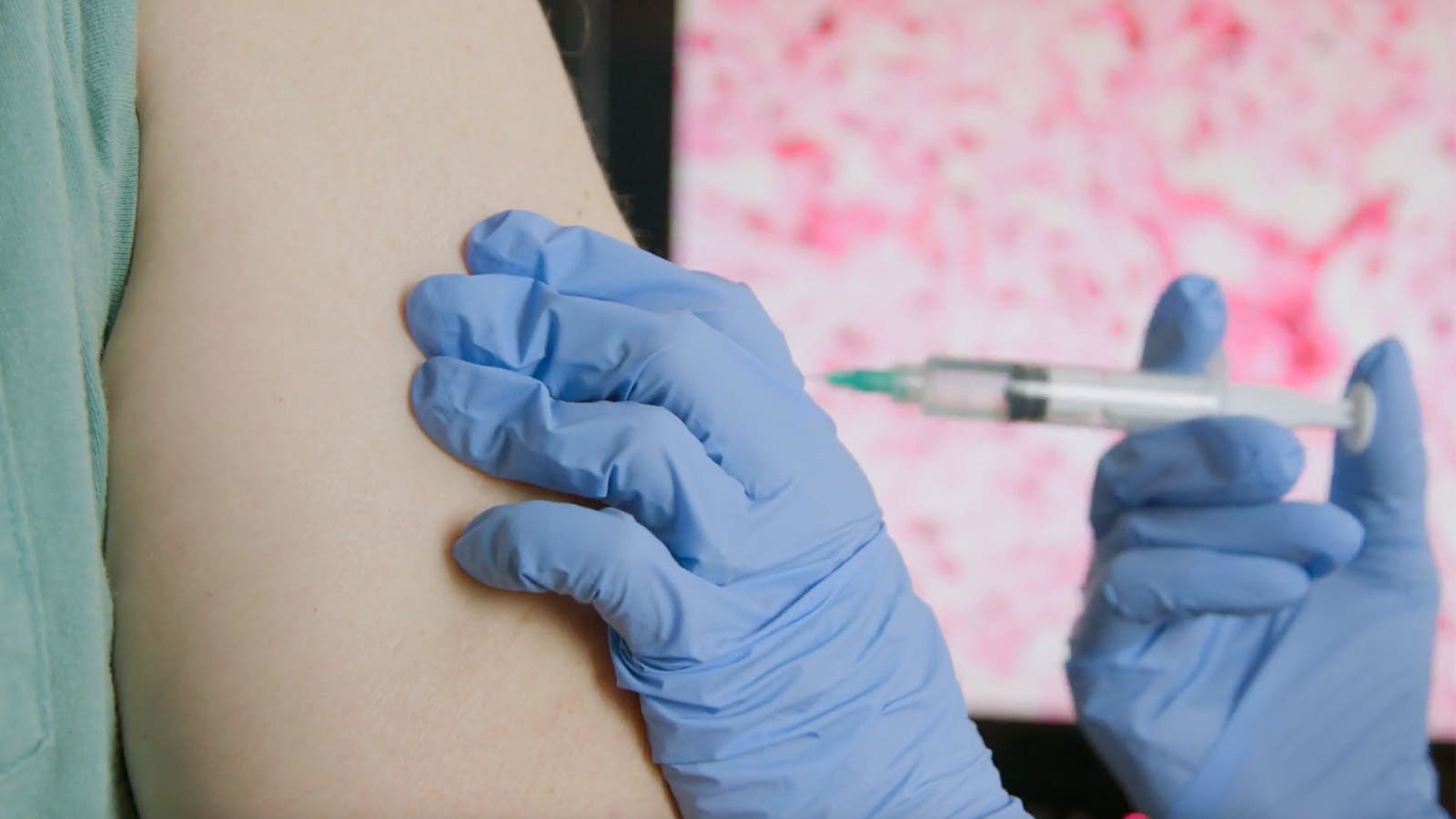 Why Measles Retains Popping Up in Pockets of the U.S.