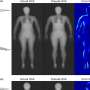 Researchers mix recent equipment for increased precision in body composition diagnosis