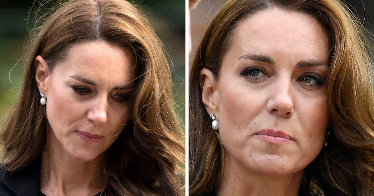 «Her Face Is Too Spherical,» Kate Middleton Considered for the first Time Since Surgical treatment (Pic Inner)