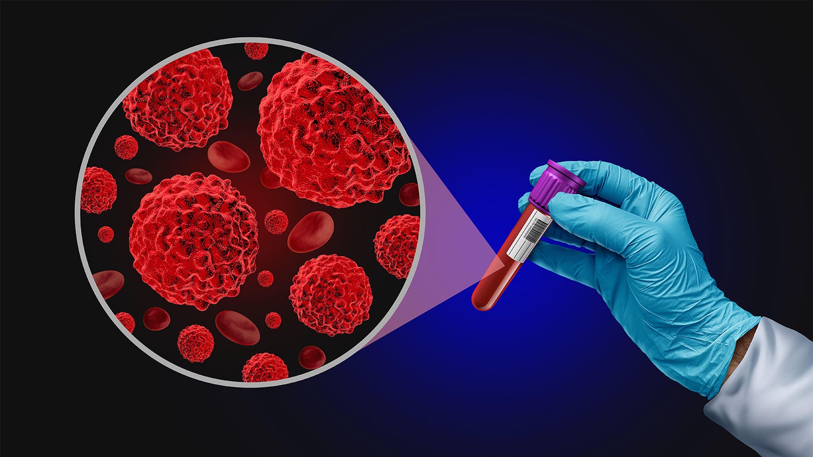 Liquid Biopsy for CRC Screening Might maybe maybe maybe No longer Be Ready for Prime Time