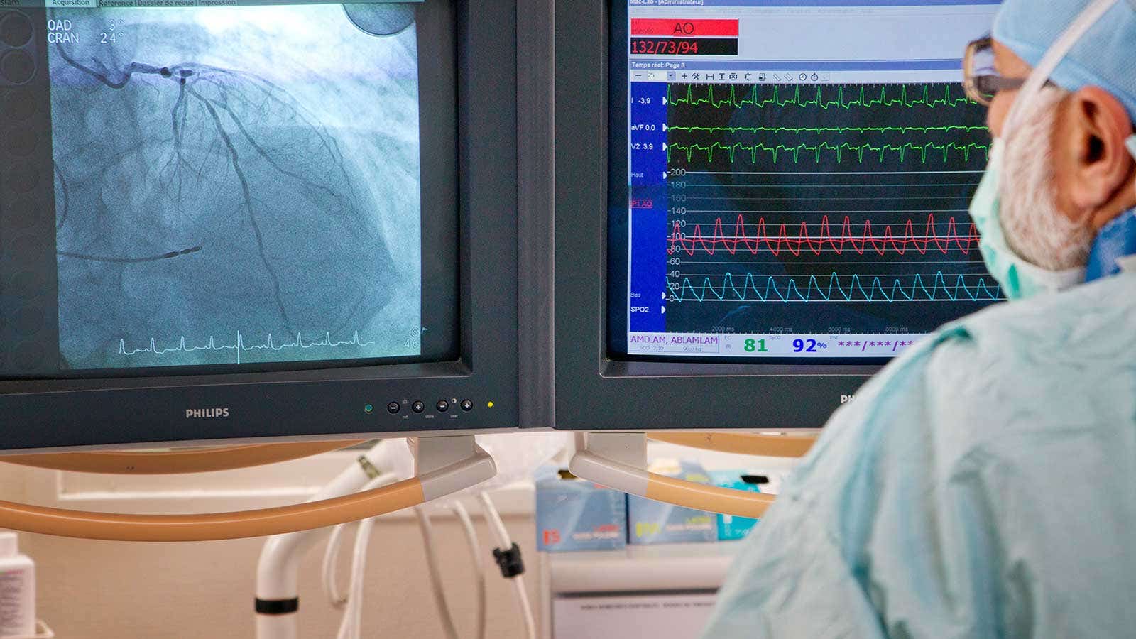 Culprit Lesion PCI Sooner than Diagnostic Angiography for Faster STEMI Reperfusion
