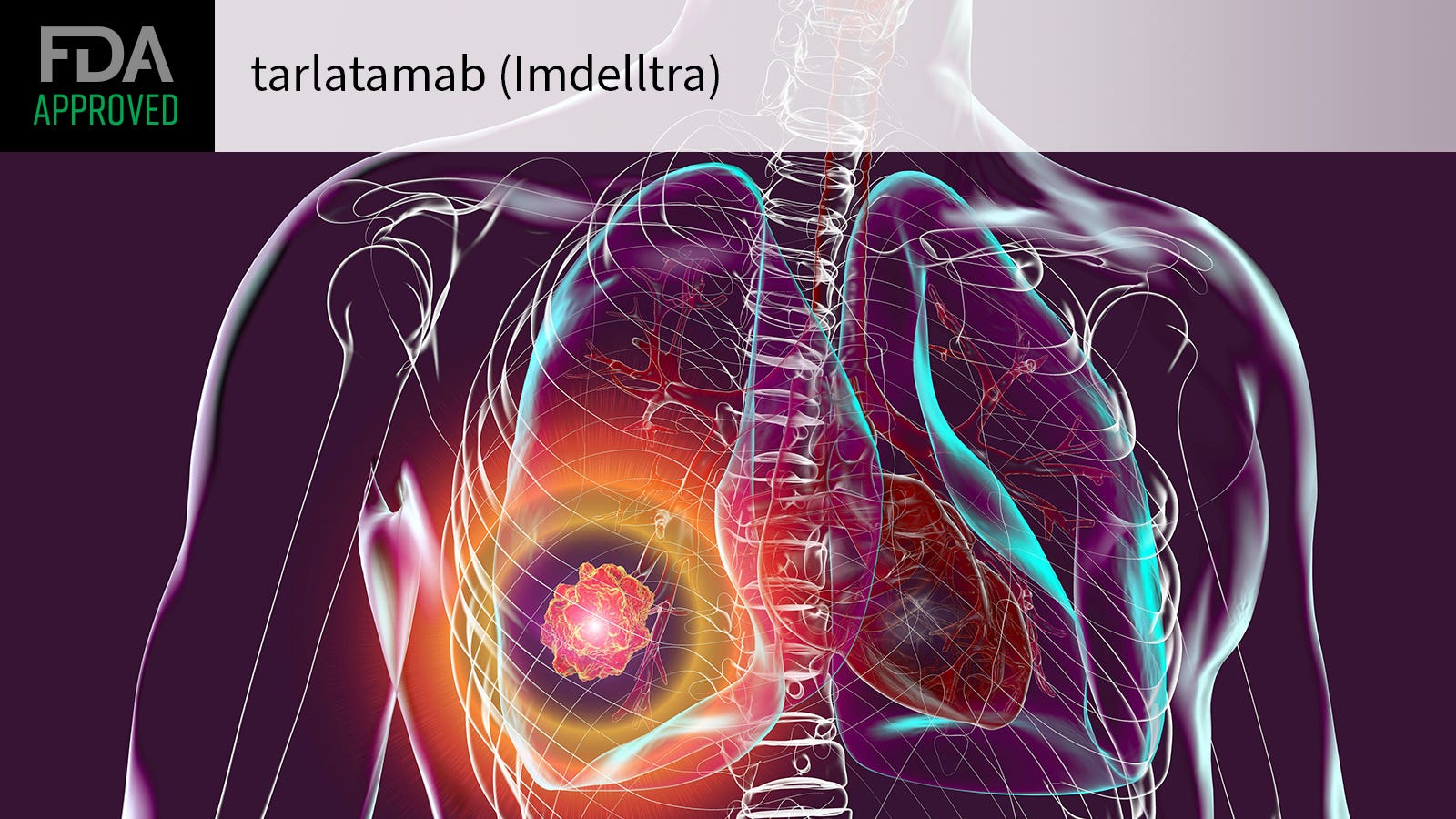 FDA OKs Original BiTE Agent for Puny Cell Lung Most cancers