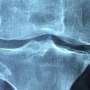 Naturally-going down peptide reveals promise as fresh therapeutic in bone repair