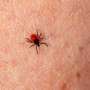 Ticks and the ailments they devise