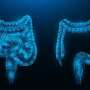 Combo remedy boosts survival for evolved colon cancer