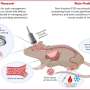 Noninvasive focused ultrasound display capacity for combating chronic anxiousness