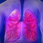 Idea how deadly lung cancers regulate the local immune system